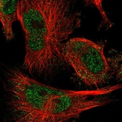 FAAP100 Antibody, Novus Biologicals 0.1mL; Unlabeled:Antibodies, Polyclonal